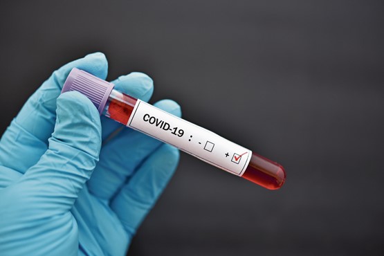 Le Coronavirus et ses conséquences nous font prendre conscience de la vulnérabilité de notre système de santé. Photo: 123RF